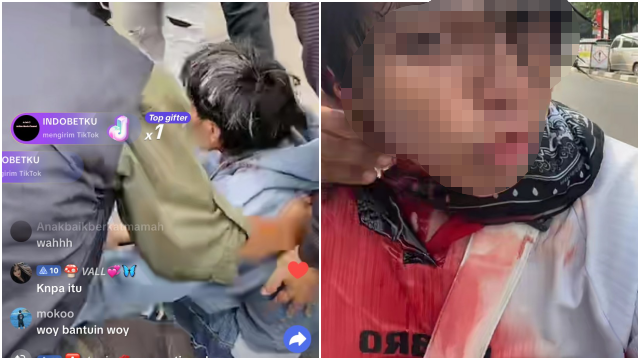 Massa Demo 25 Agustus Tergeletak di Depan DPR, Kepalanya Bocor