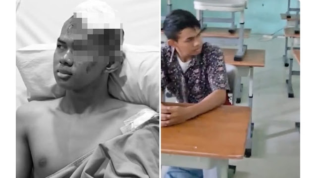 Pelaku Peledakan di SMAN 72 Jakarta Ditetapkan Anak Berkonflik dengan Hukum, Pasal Ini Menjeratnya